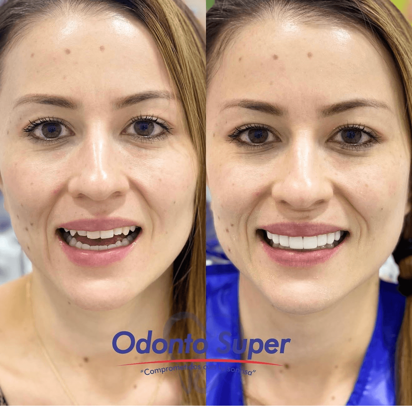A real patient at ease, smiling before and after treatment